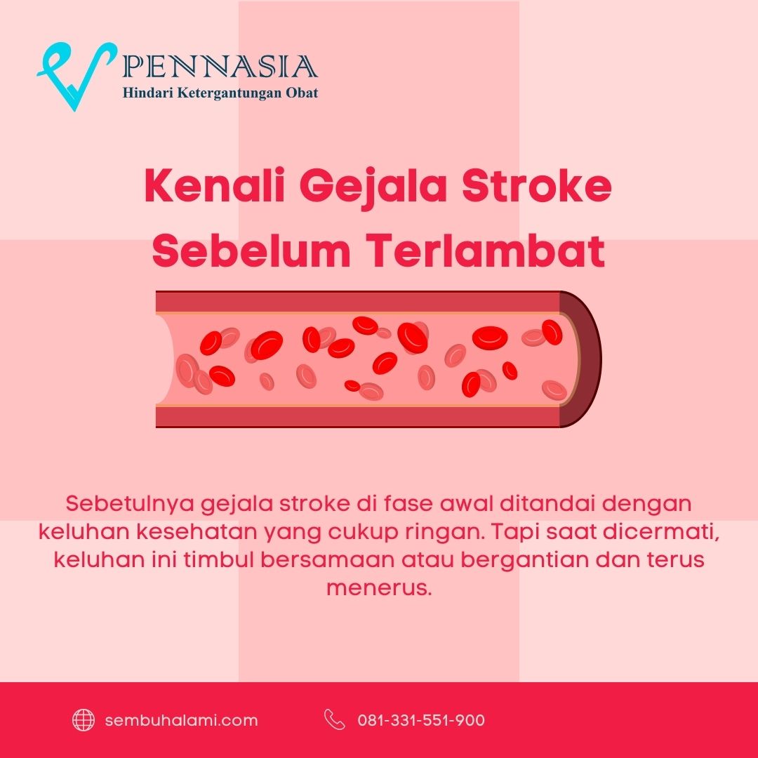 kenali gejala stroke sebelum terlambat