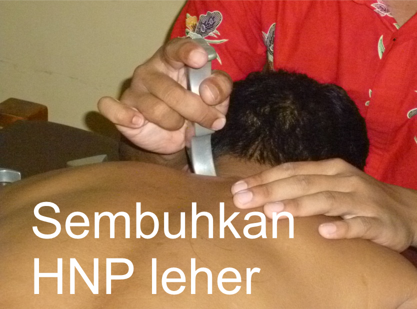 Sembuhkan HNP leher
